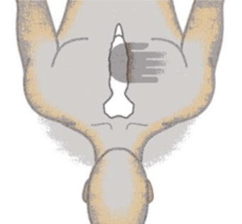 胸骨圧迫の手を置く位置
