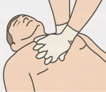 胸骨圧迫の方法 | 胸骨圧迫の際の手の位置・深さ・速さ（リズム）などポイントを解説